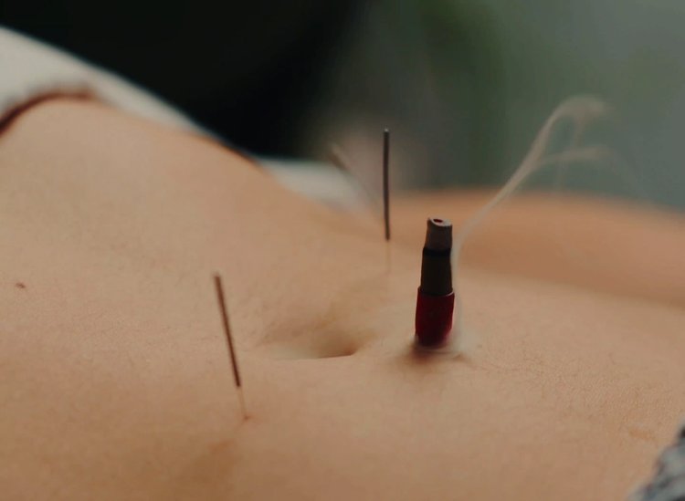 Infrared Heat Moxibustion
